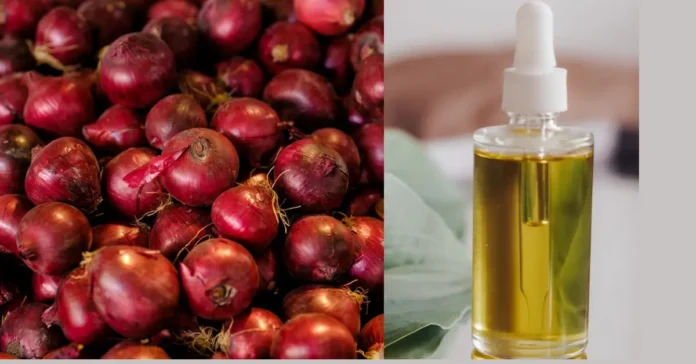 onion oil benefits